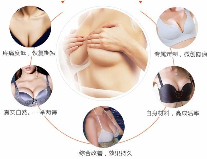 自体脂肪丰胸优点