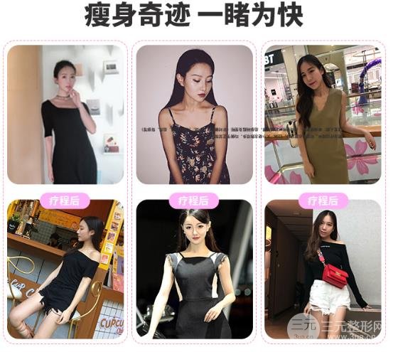 中医中医减肥价钱