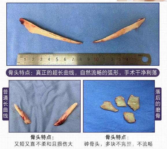 削骨手术的价格