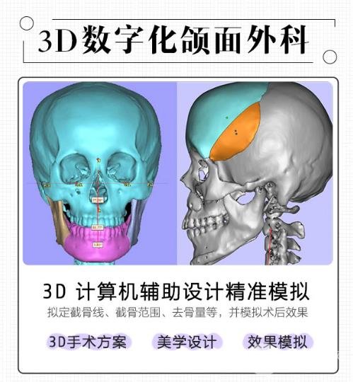 影响削骨手术价格的因素