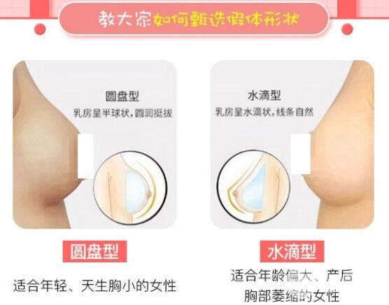 盘点曼托妙桃假体都有哪些型号,贵妇专用款
