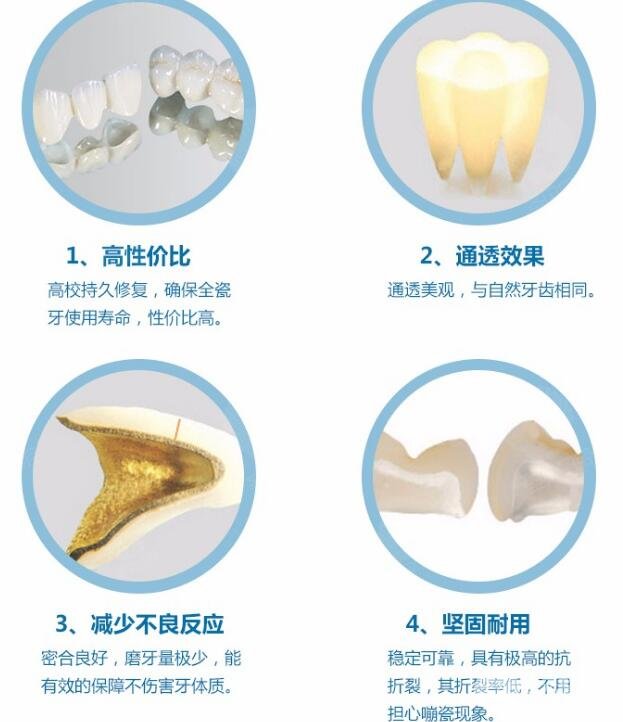 钛烤瓷牙这个材料的特点属性科普~