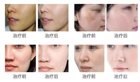 术者自身条件不同