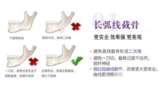 地域条件不同