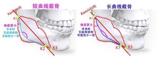 选取医院不同