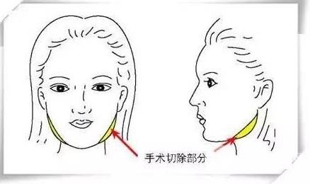 自身条件不同
