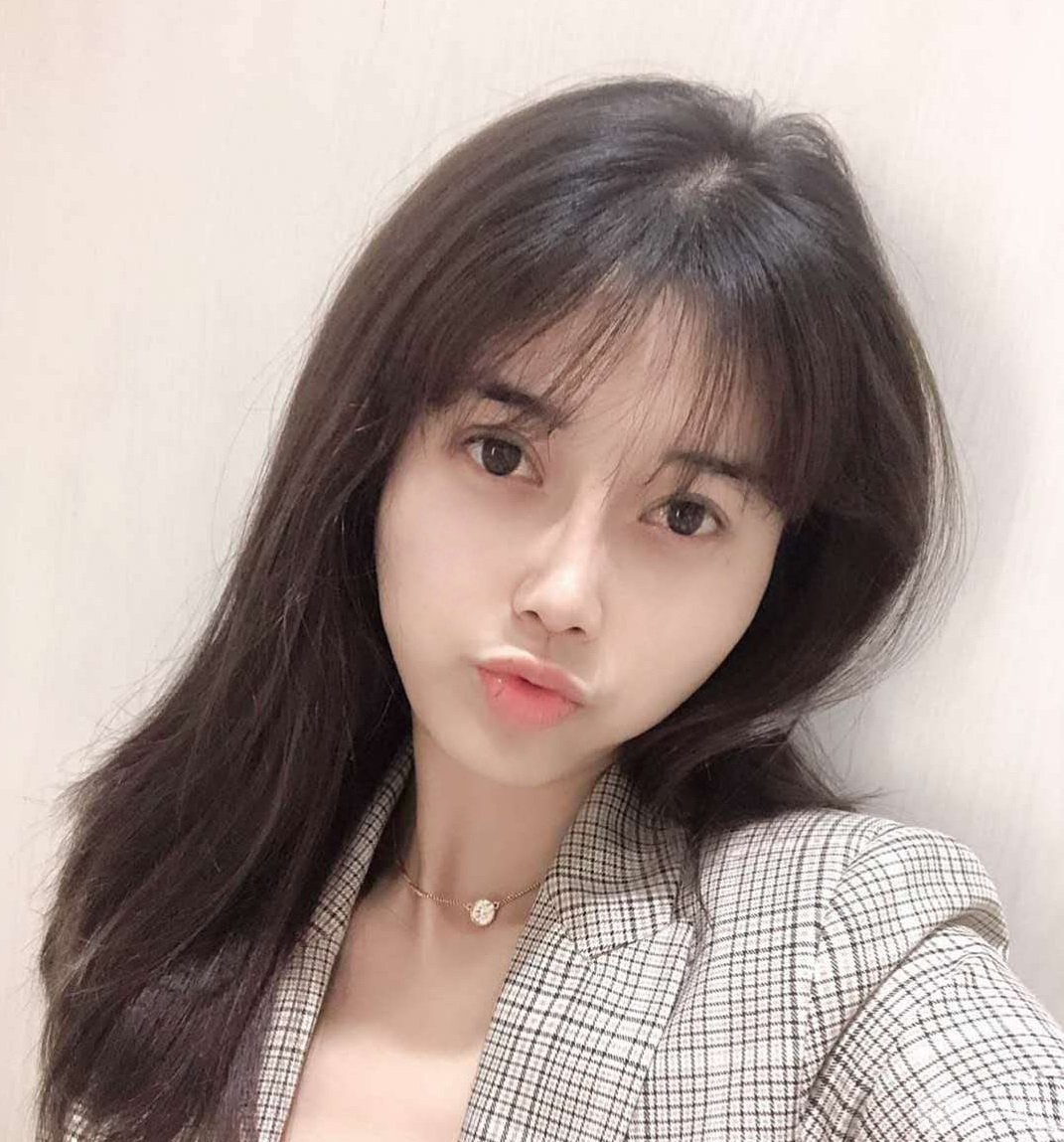 北京八大处李发成脂肪填充怎么样康康案例图