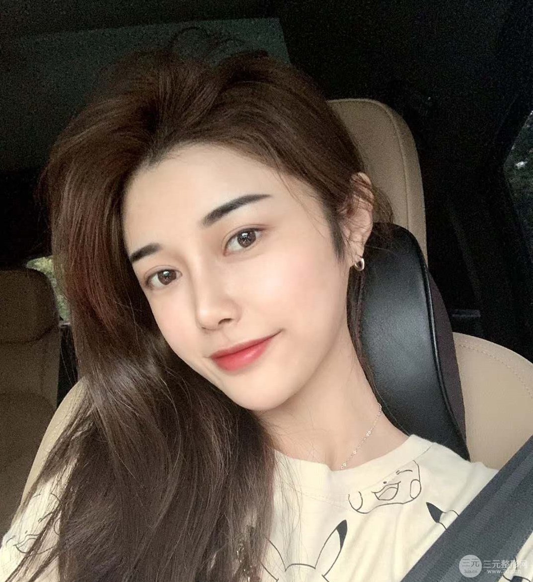 北京八大处李发成脂肪填充怎么样康康案例图