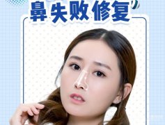 隆鼻失败怎么办？别慌，这里有自救指南！