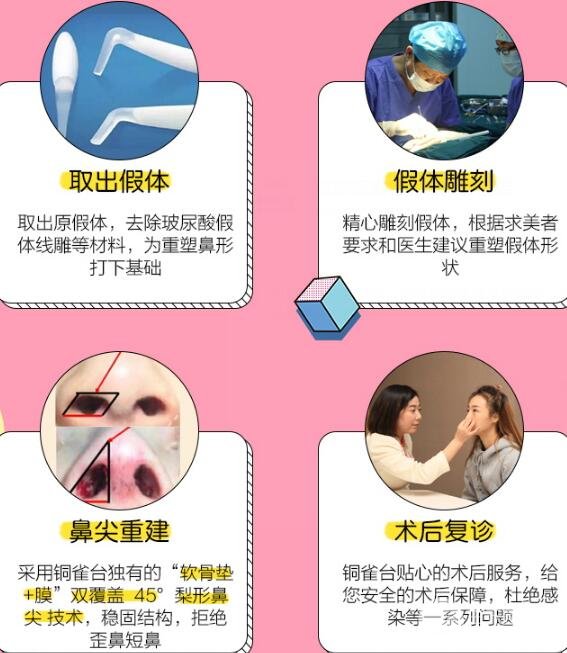 隆鼻失败怎么办?别慌,这里有自救指南!