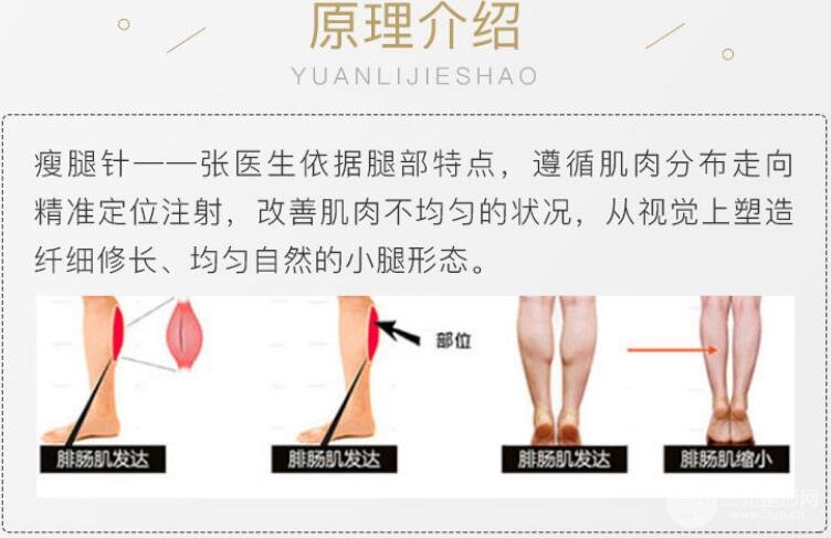 注射瘦脸瘦腿需要注射多少单位？脂肪型小腿就别来“掺和”了