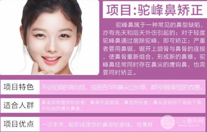 击穿谎言！驼峰鼻修复价格到底贵不贵？