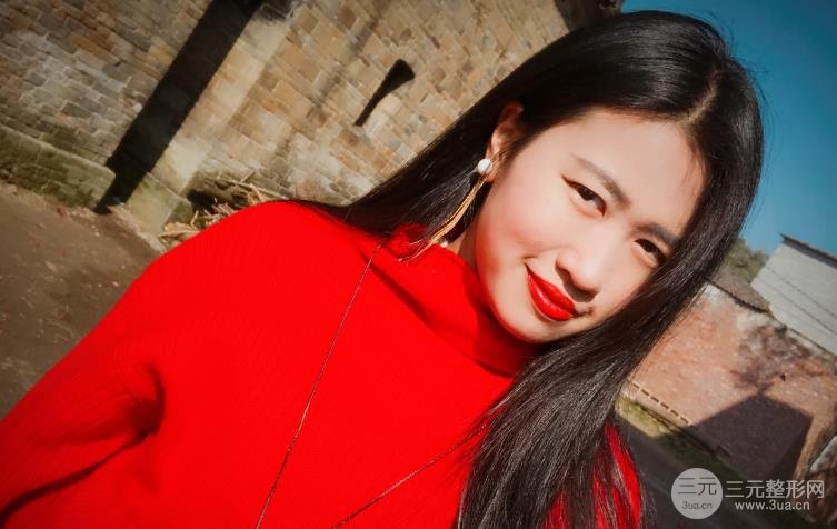 北京301郭伶俐双眼皮手术案例已经3个月了