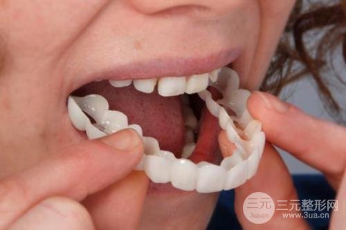 美容冠多少钱一颗？费用解析大全~