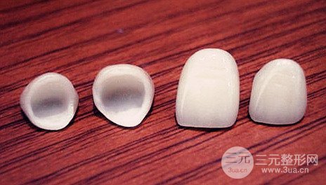 美容冠多少钱一颗？费用解析大全~