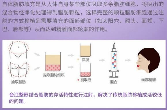 详细部自体脂肪填充果：美图放送~