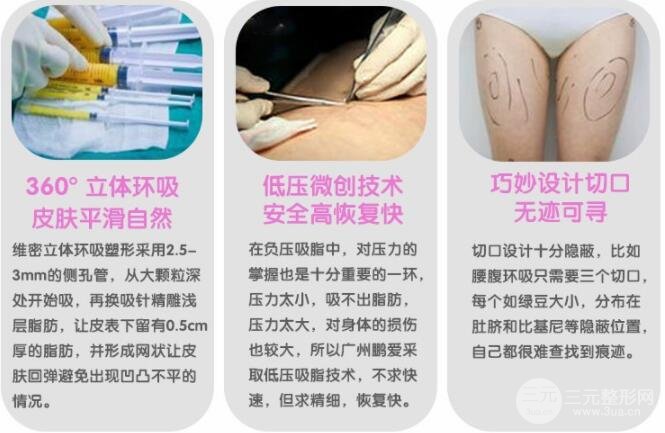 吸脂瘦大腿肿胀期