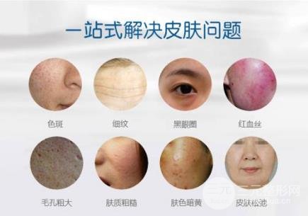 光子嫩肤哪家医院好 谨记这几点很重要~