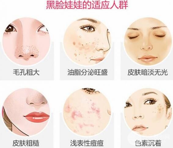 [美肤攻略]黑脸娃娃费用和效果揭秘