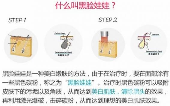 [美肤攻略]黑脸娃娃费用和果