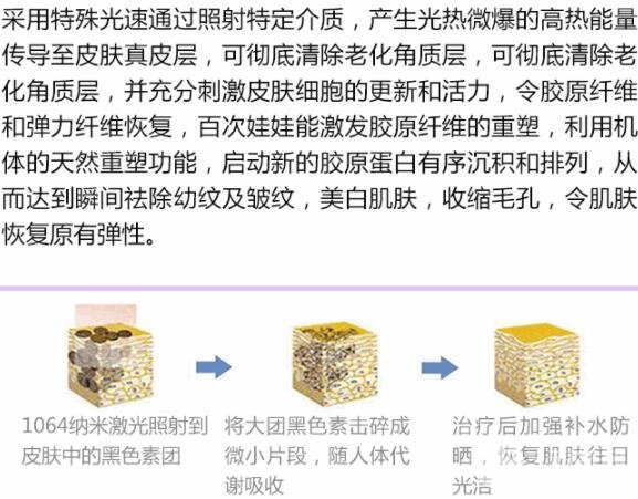 医美小课堂:白瓷娃娃激光功及果图