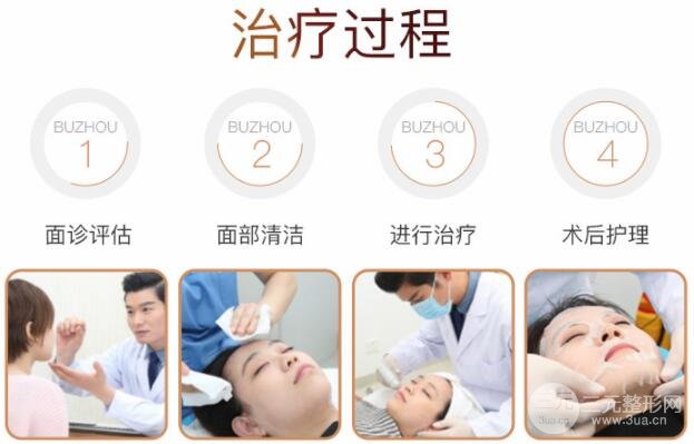 医美小课堂:白瓷娃娃激光功及果图