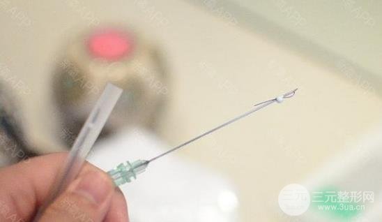 不到30岁可以做埋线面部除皱吗?注意事项有哪些?