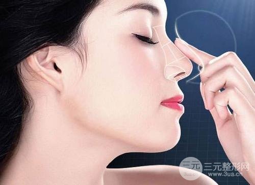 假体隆鼻注意事项有哪些呢?赶紧来科普一下吧~