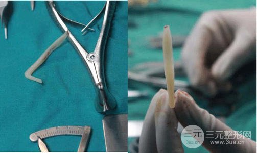 假体隆鼻注意事项有哪些呢?赶紧来科普一下吧~