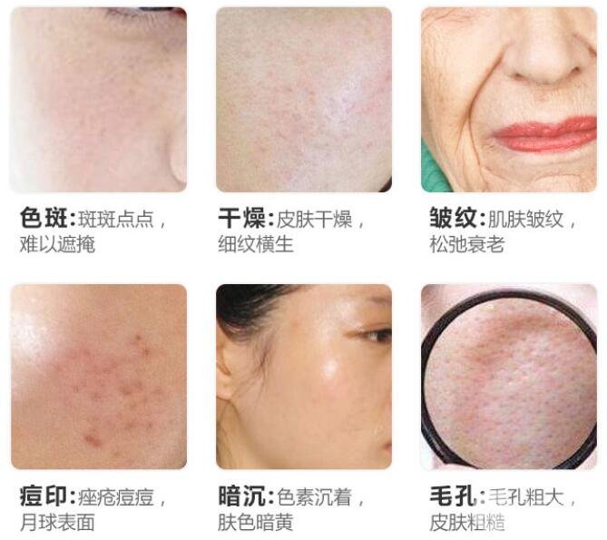 #医美科普#黑脸娃娃手术价格&果全攻略