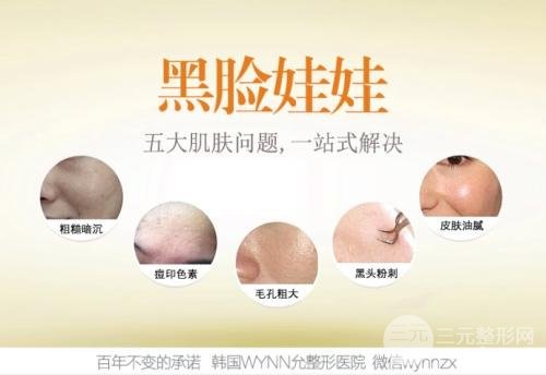 黑脸娃娃的费用多少钱一次？黑脸娃娃果有哪些？