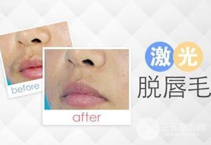 面部激光脱毛手术以后注意事项