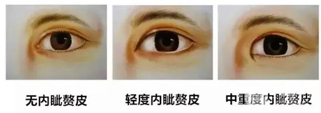 开外眼角的价格