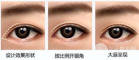 开外眼角的价格