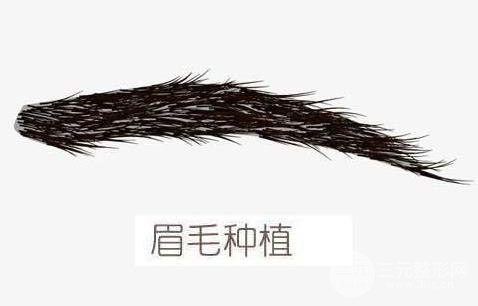 种植眉毛前的注意事项