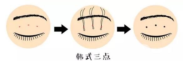 微创定点式好吗?果和优势有哪些?