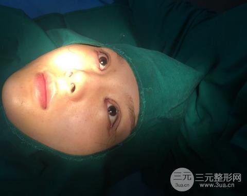 北京301医院整形科好不好？双眼皮案例给你答案！