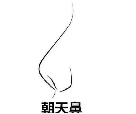 朝天鼻矫正要多少钱？