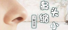鼻头缩小术需要多少钱?手术收费情况分析 鼻头缩小术需要多少钱?手术收费情况分析