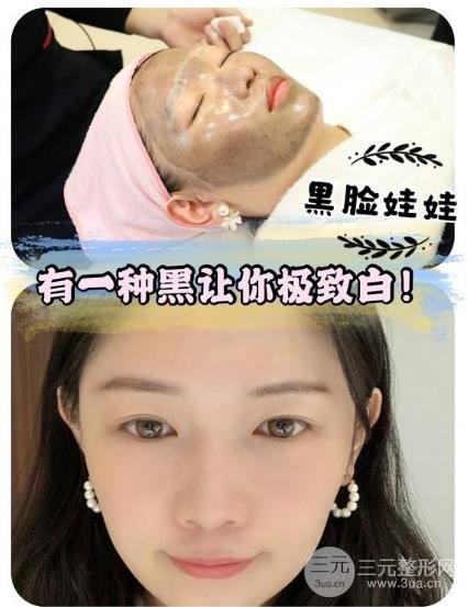 做黑脸娃娃后的注意事项