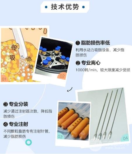 体脂肪移植隆胸前注意事项
