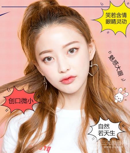 专业双眼皮手术费用