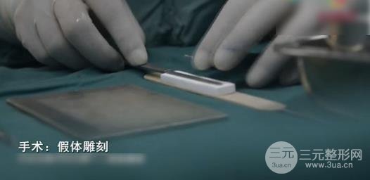 假体隆鼻手术前注意事项