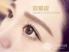爱美小仙女10问：埋线法双眼皮多少钱？