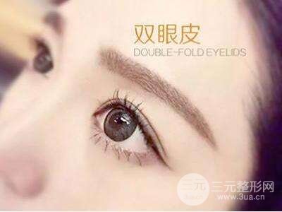 爱美小仙女10问:埋线法双眼皮多少钱?
