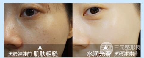 什么是黑脸娃娃?
