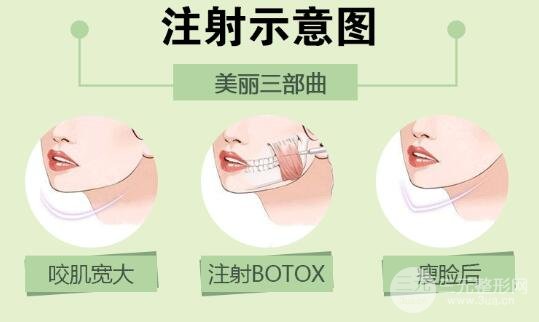 脸针之前注意的事情