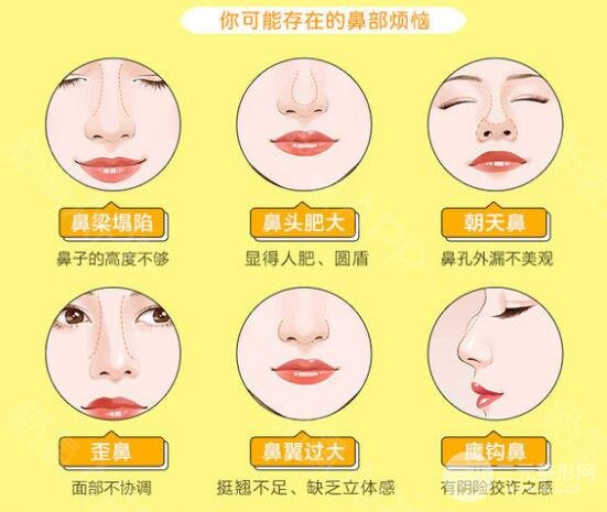 术需要的费用