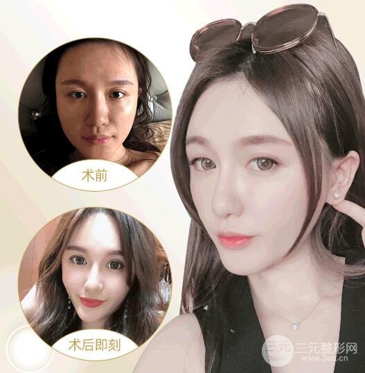 手术的果