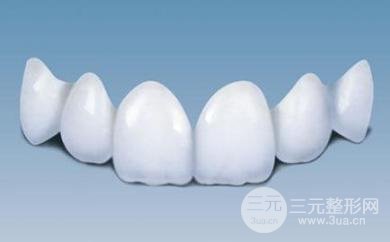 #揭开内幕#各种烤瓷牙的价格是多少？提前了解一下~